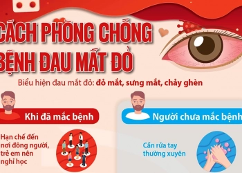 TB v/v phòng chống dịch đau mắt đỏ cho sinh viên Trường Đại học Quốc tế